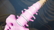 Medical illustration of the lumbar spine and sacrum